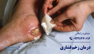 درمان زخم بستر