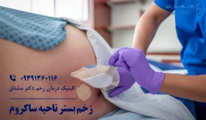 زخم بستر ناحیه ساکروم
