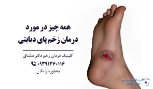 درمان زخم پای دیابتی