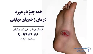درمان زخم پای دیابتی