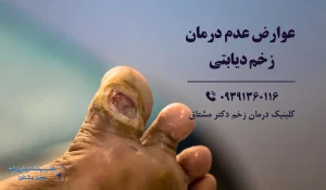 عوارض عدم درمان زخم پای دیابتی