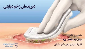 درمان زخم پای دیابتی دبریدمان