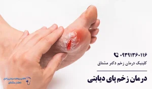 درمان زخم پای دیابتی