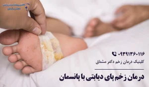 درمان زخم پای دیابتی با پانسمان