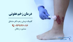 درمان زخم عفونی