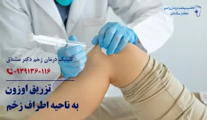 اوزون درمانی زخم تزریق اوزون
