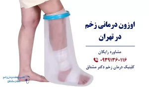 اوزون درمانی زخم در تهران