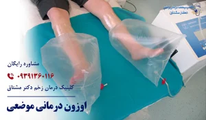 اوزون درمانی زخم موضعی