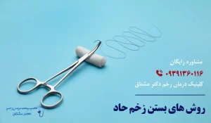 روش های بستن زخم