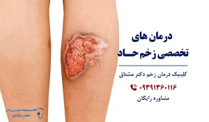 درمان زخم حاد