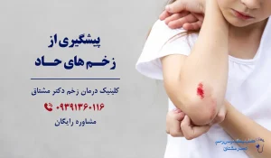 پیشگیری از زخم حاد