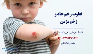 تفاوت زخم حاد و زخم مزمن