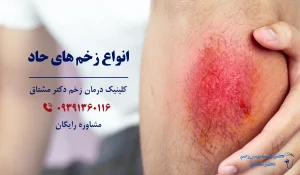 انواع زخم حاد