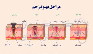 مراحل بهبود زخم