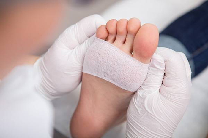 درمان زخم های پای دیابتی