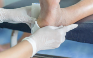 زخم پای دیابتی در چه افرادی مشاهده می شود